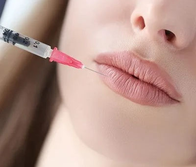 How Lip Filler Injections Can Add Volume and Shape to Your Lips