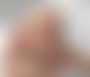حقن تجميلية للحصول على مظهر رقبة أكثر شباباً