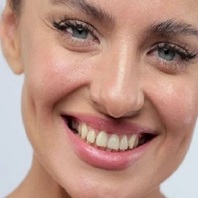 Best Dimple Creation in Oman