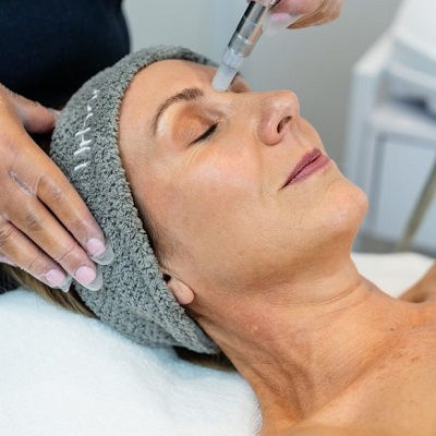 Microdermabrasion in Oman