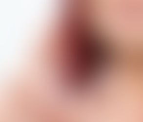 Mail-Order Aligners vs. Professional Treatment in Dubai: Pros and Cons