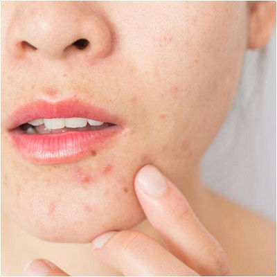 Best Dermatologist Muscat