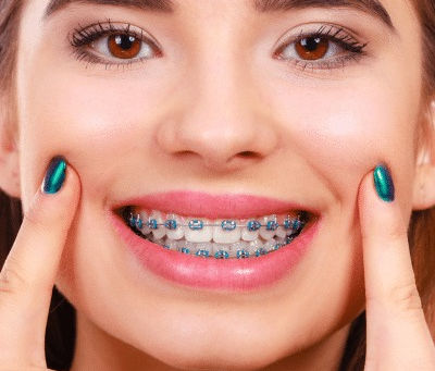 What Is the Braces Tightening Process?