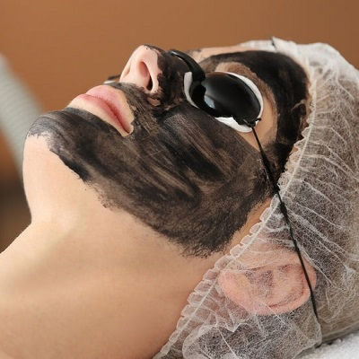 Laser Carbon Peel Muscat