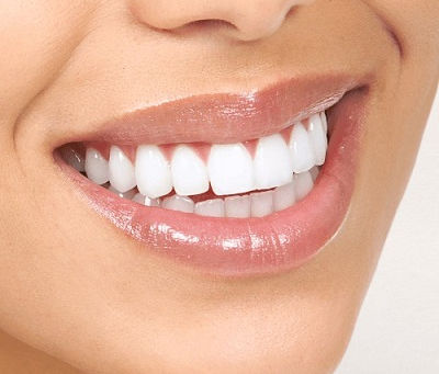 What Is a Hollywood Smile and How Does It Work?