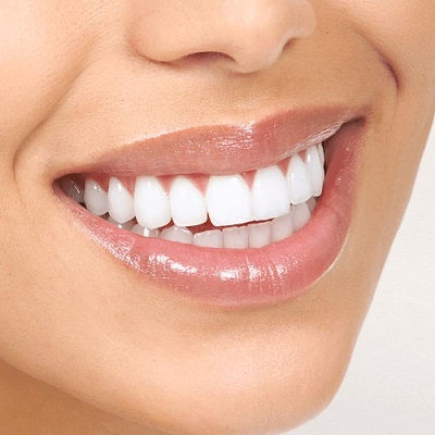 Best Hollywood Smile Design Dubai