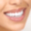 What Is a Hollywood Smile and How Does It Work?