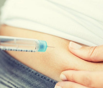How Zepbound Injections Work: A Comprehensive Guide