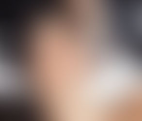 هل يمكن أن يساعد علاج الهيدرافيشل في علاج الاحمرار؟