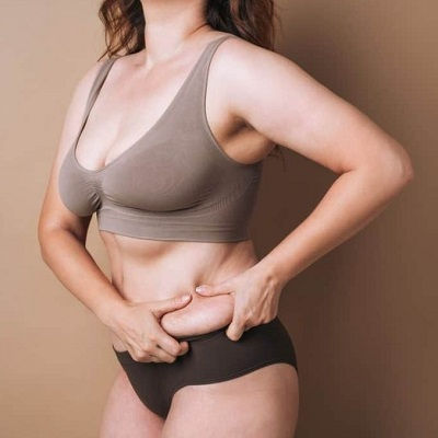 Post Weight Loss in Muscat