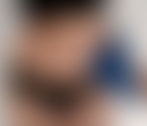 كيف تساعد عملية شد البطن بعد فقدان الوزن الكبير؟