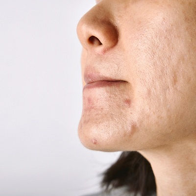 Best Dermatologist in Muscat