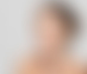 Can Profhilo Help with Scalp Skin Rejuvenation?