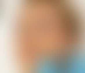 JUVÉDERM VOLBELLA vs. Botox: Which Is Better for Facial Aging?