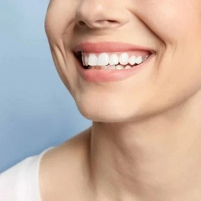 Gingivectomy in Dubai