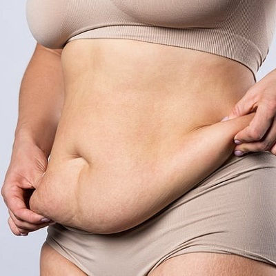 Best Post Weight Loss in Muscat