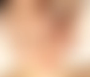 The Role of Microdermabrasion in Anti-Aging Skincare