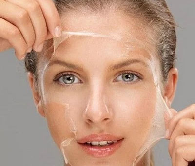 What Skin Type Responds Best to TCA Peel Treatments?