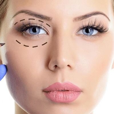 Plexr Plasma Eye Lift Clinic in Oman