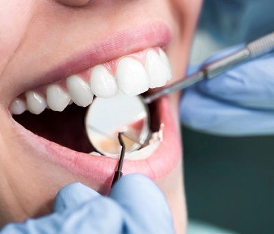 Can Full Mouth Rehab Fix Overbites?