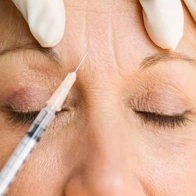 حقن البوتوكس في مسقط