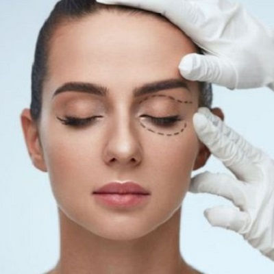 Eyelid Surgery in Muscat