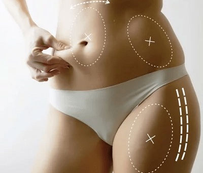 The Latest Innovations in Body Fillers for 2025