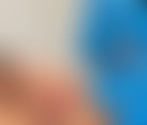 How Lip Filler Injections Help With Lip Deflation Due to Aging
