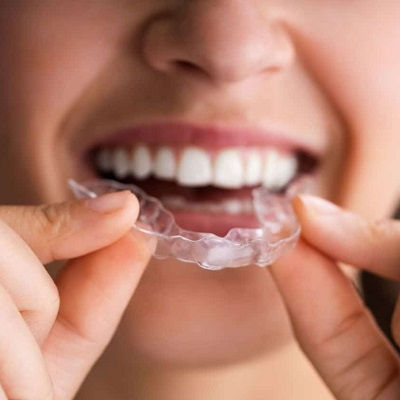 Best Aligners Dubai