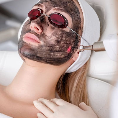 Best Laser Carbon Peel in Musca