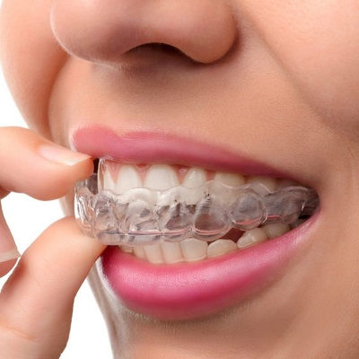 Dental Appliances Dubai