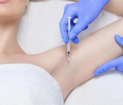 How Laser Treatment Can Reduce Excessive Sweating