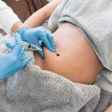 Fat Melting Injections Oman