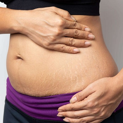 Post Weight Loss Clinic in Muscat