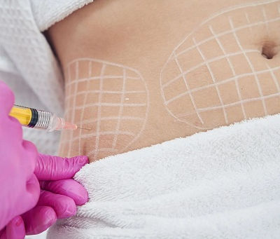 حقن إذابة الدهون مقابل شفط الدهون: الاختلافات الرئيسية