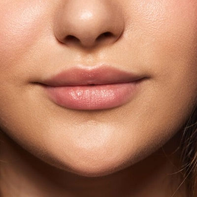 Lip Fillers Injections in Oman