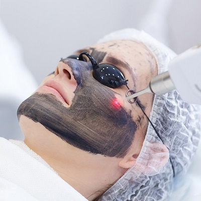 Laser Carbon Peel in Oman