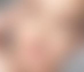 How Eyelid Surgery Can Improve Vision and Eye Comfort