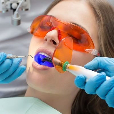 Dental Tooth Filling in Dubai
