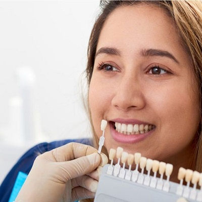 Best Lithium Disilicate Veneers Dubai
