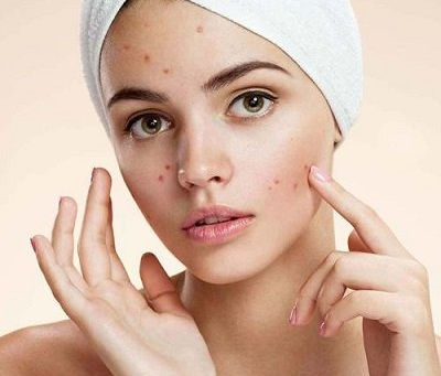 TwAc Treatment: What It Is, How It Works, and Who Needs It