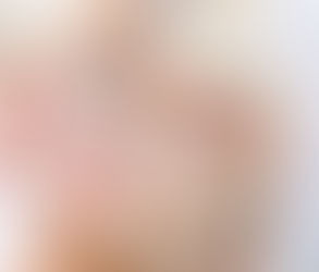 Is Green Peel Safe for Sensitive Skin?
