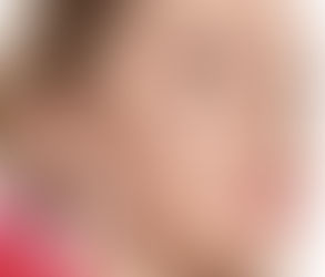 Skin Booster Injections in Muscat: A New Era of Hydration and Glow