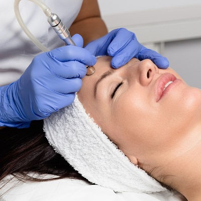 Microdermabrasion in Muscat