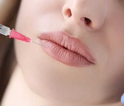 The Best Aftercare Tips for Lip Filler Injections