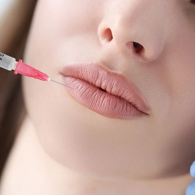 Lip Fillers Injections Oman