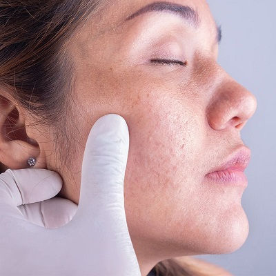 Dermatologist in Muscat