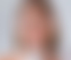 بيبي بوتوكس لعلاج خطوط العبوس: دليل سريع