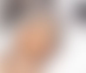 فهم التقشير من خلال التقشير الكيميائي