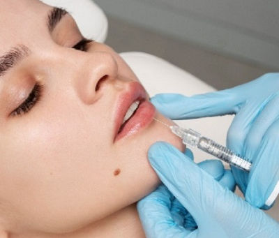 Are Lip Fillers Considered Plastic Surgery?